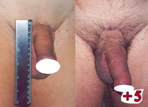 emaitzak aurretik eta ondoren kidea handituz